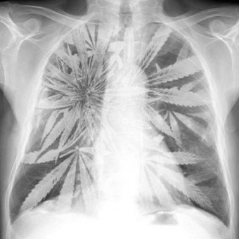 Palenie marihuany, a rak 
